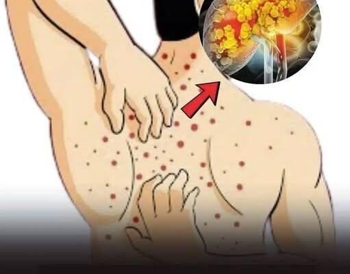 😱 Fettleversykdom (hepatisk steatose): årsaker, symptomer, behandling og kjerringråd 🌿 Det du trenger å vite for å beskytte leveren – se mer i den første kommentaren 👇 👇